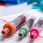 Die Top 5 Blutwerte und ihre Bedeutung Die Top 5 Blutwerte und ihre Bedeutung