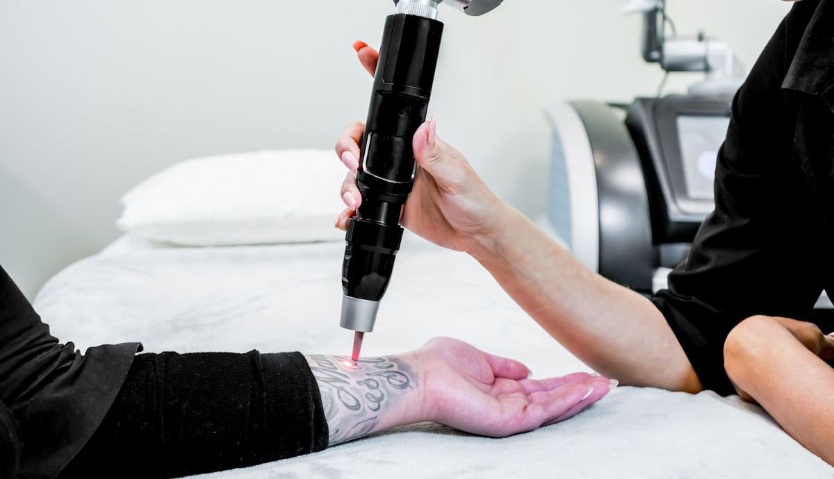 Tattoo-Entfernung dank Laser